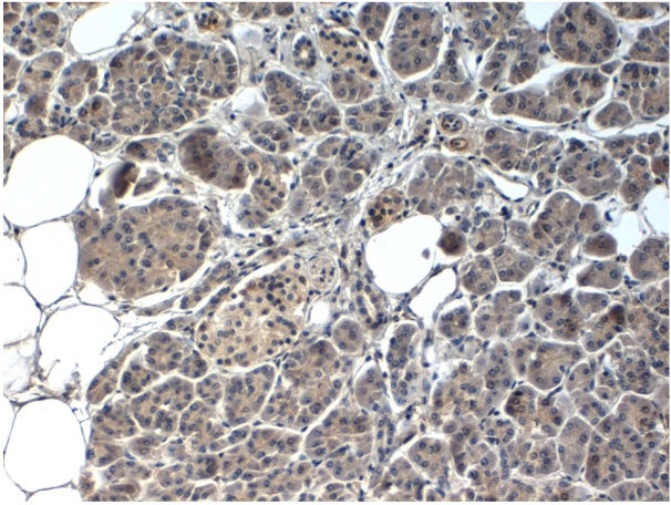 Immunohistochemical staining of FFPE human pancreas tissue using PDX1 antibody (Cat. No. X2755P).  Antibody used at 1 µg/ml and visualized using DAB.  Pathologists comments: Positive nuclear and partial cytoplasmic staining.